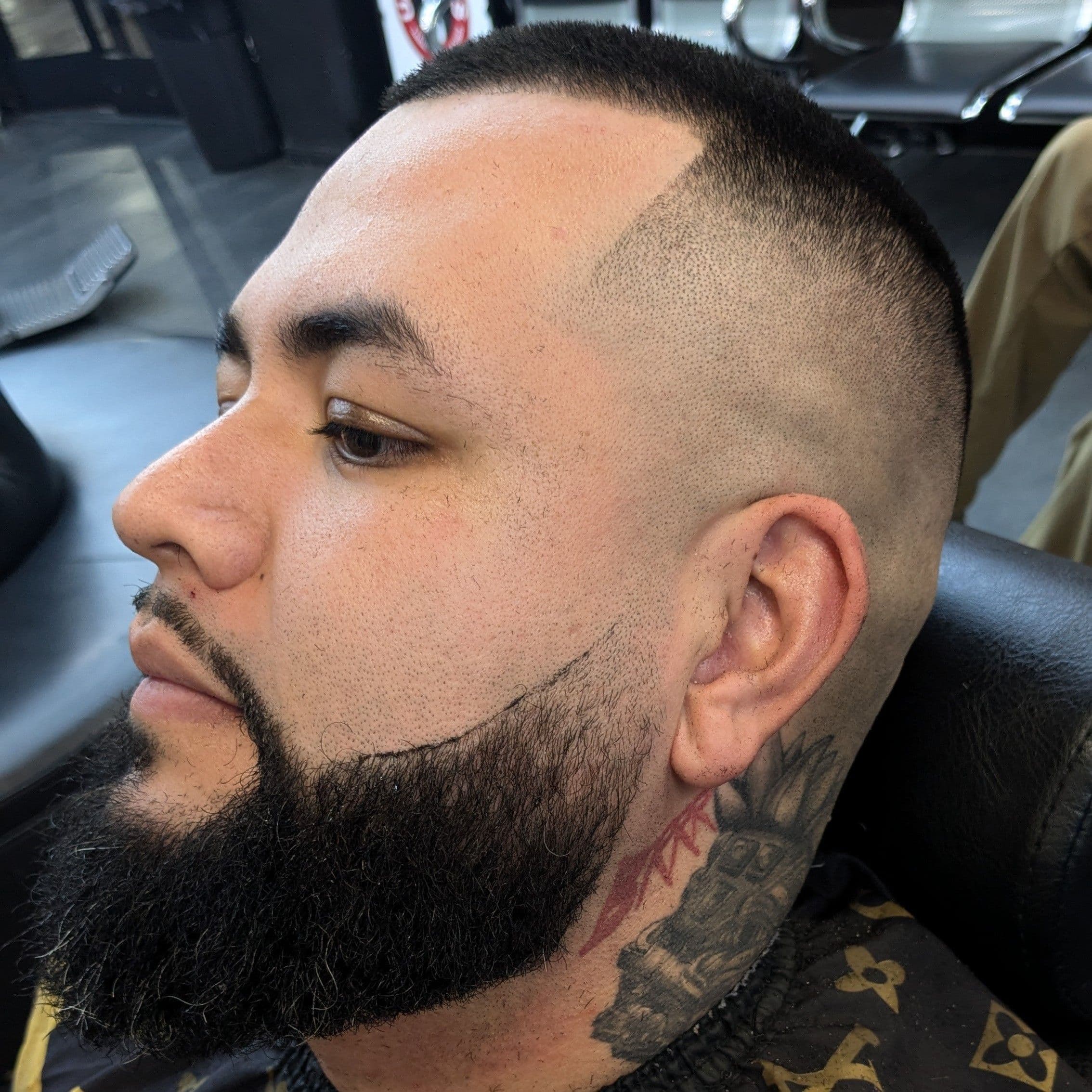Tight line-up, Uppercuts SD